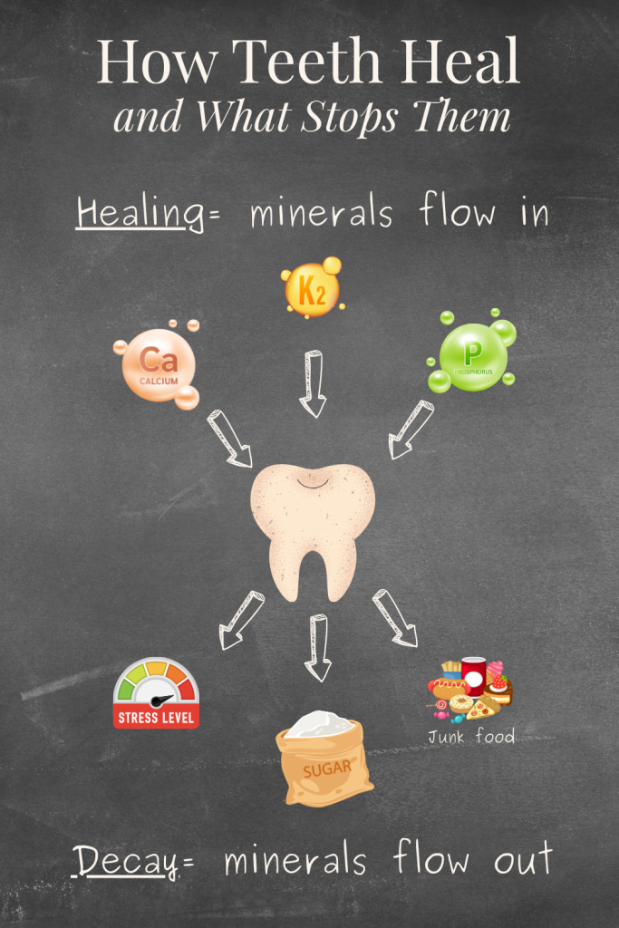 Chalkboard-style diagram showing minerals moving into and out of a tooth, labeled with healing nutrients and decay triggers.